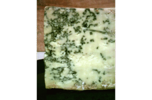 Dead-hair-follicles-from-lichen-planopilaris