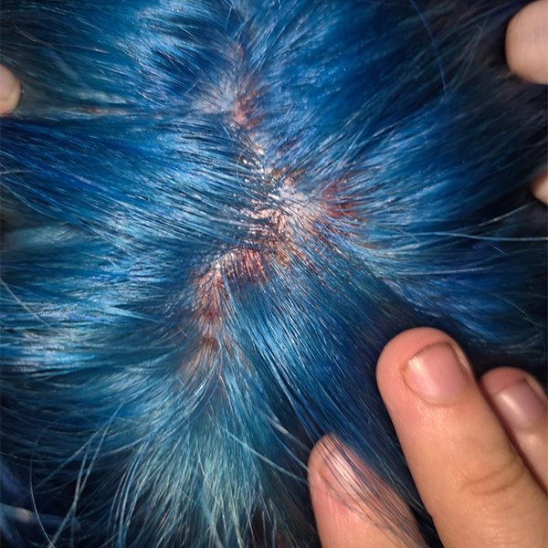 Chemical Hair Color side effects