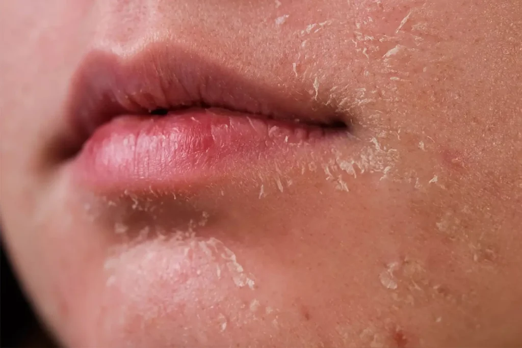 Skin Care Chemicals side effects